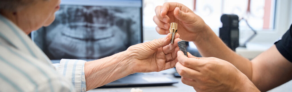 Dental Implant Budgeting