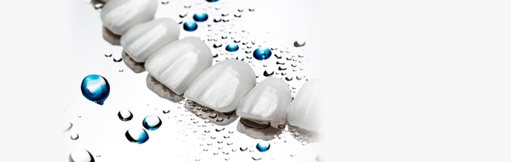 Cost of Dental Veneers