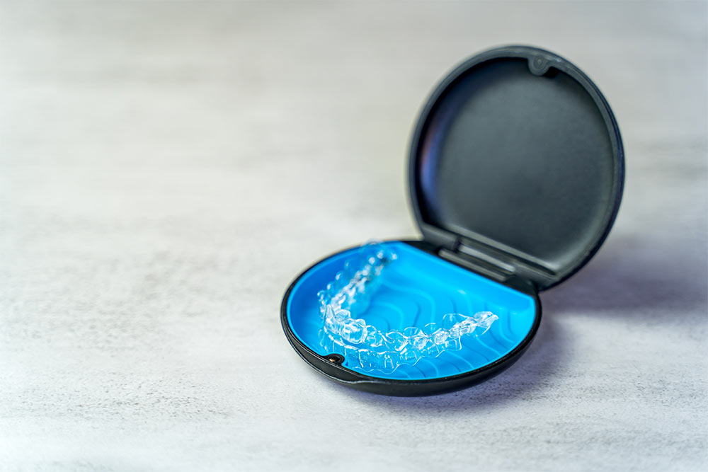 Invisalign Aligners