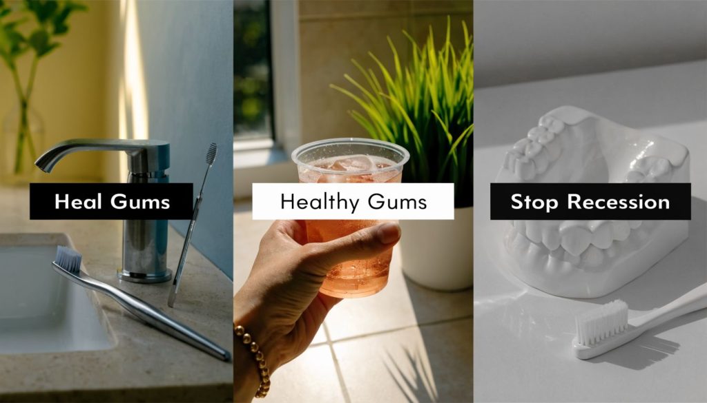 How To Treat Gum Recession At Home Dental Care 1024x585