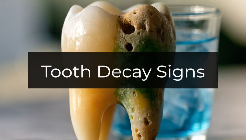 What Are The Signs Of Tooth Decay Decayed Tooth 1024x585