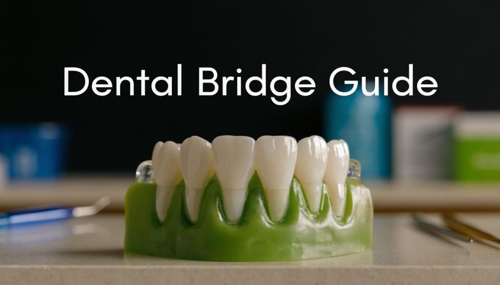 What Is A Dental Bridge Procedure Dental Bridge 1024x585
