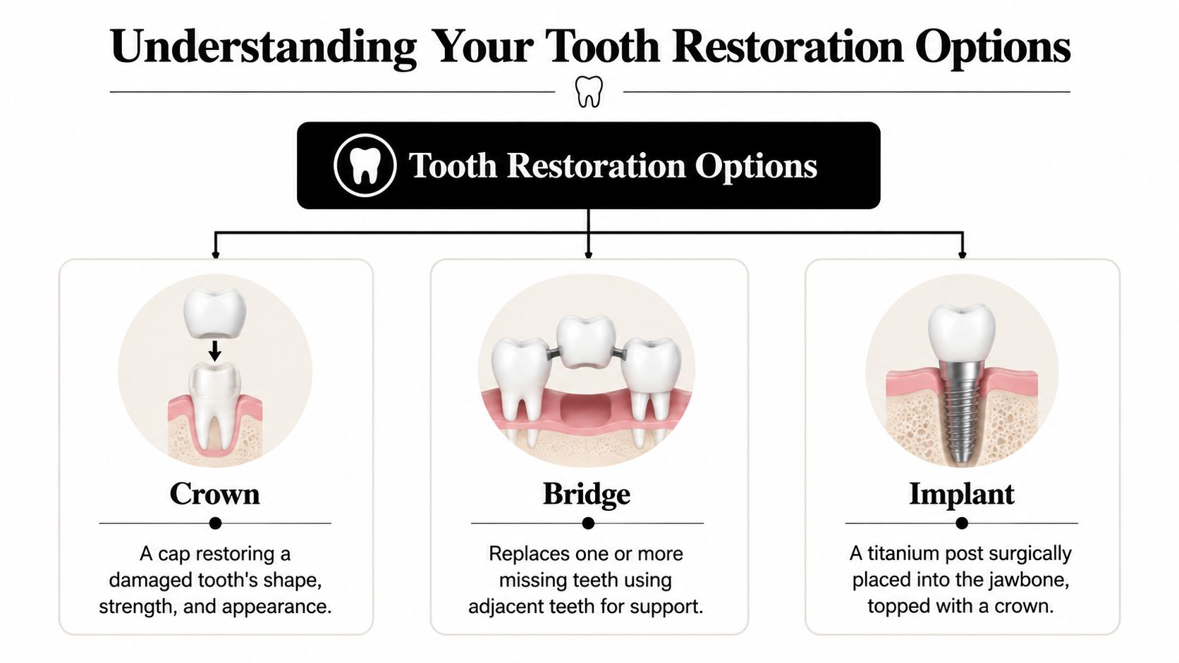 An infographic displaying tooth restoration options, specifically comparing dental crowns, bridges, and implants for tooth replacement.
