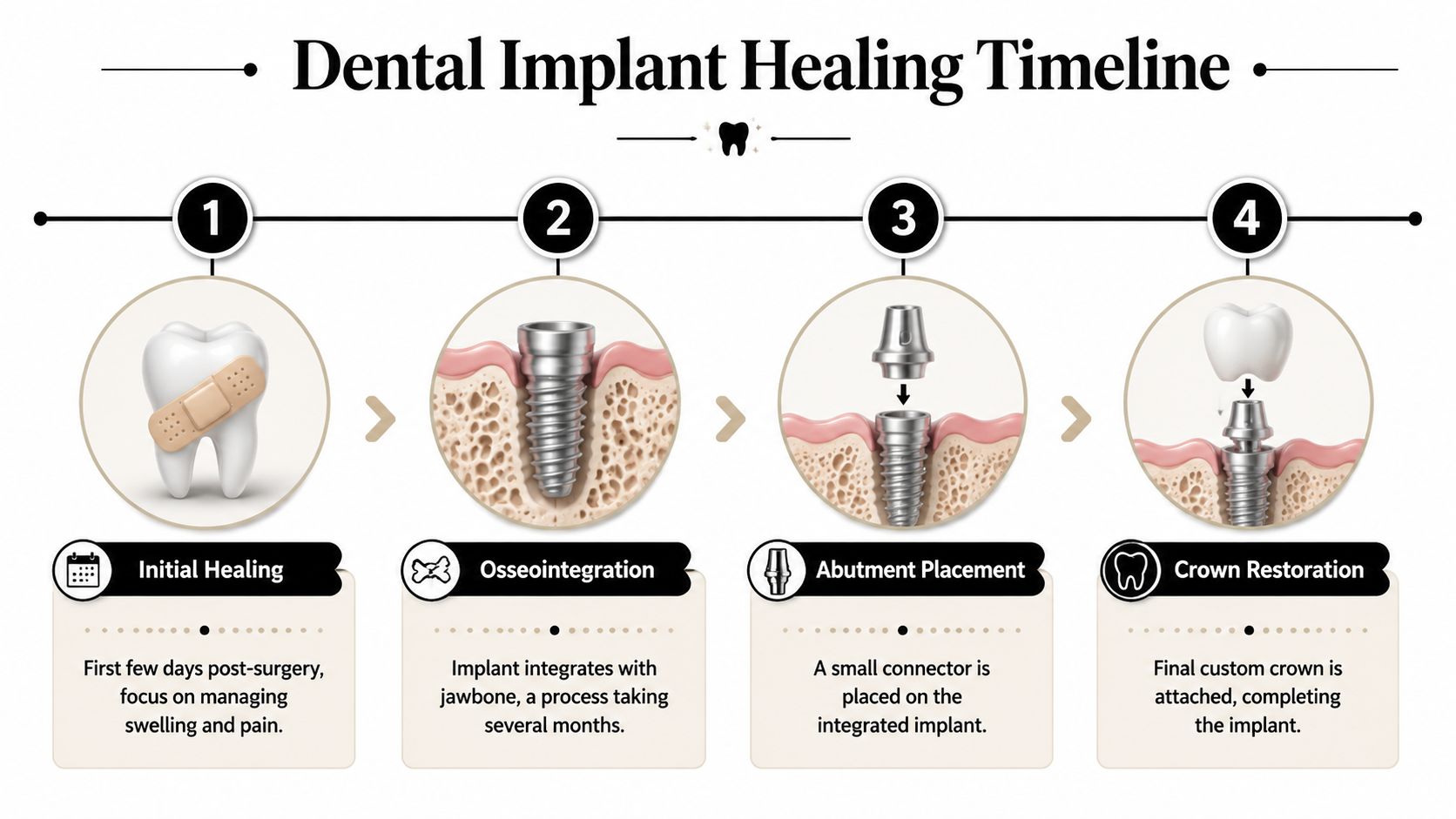 An infographic showing the four-stage dental implant healing timeline from surgery to final crown restoration.