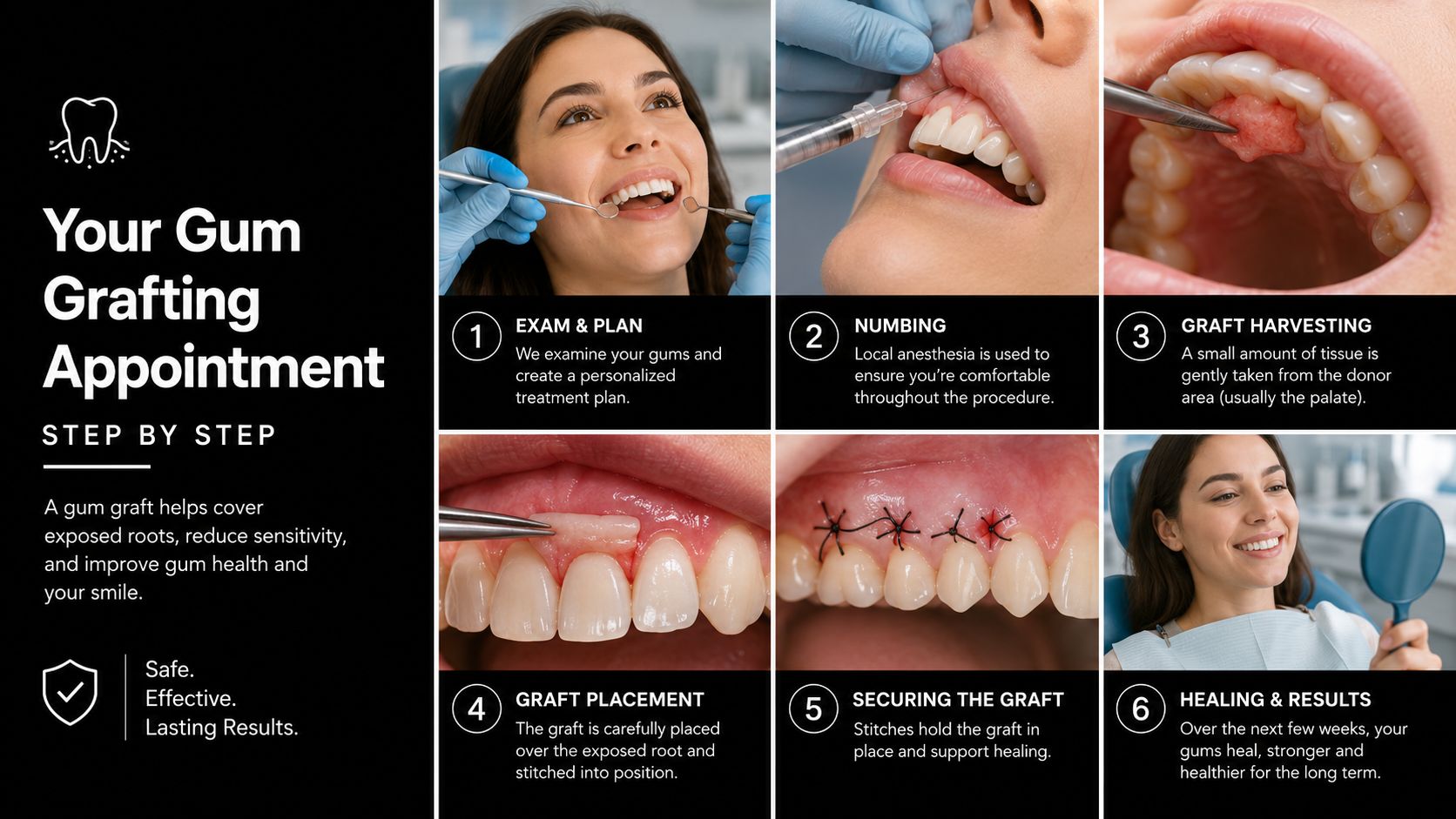 A six-step infographic explaining the dental gum grafting procedure from examination to healing and final results.