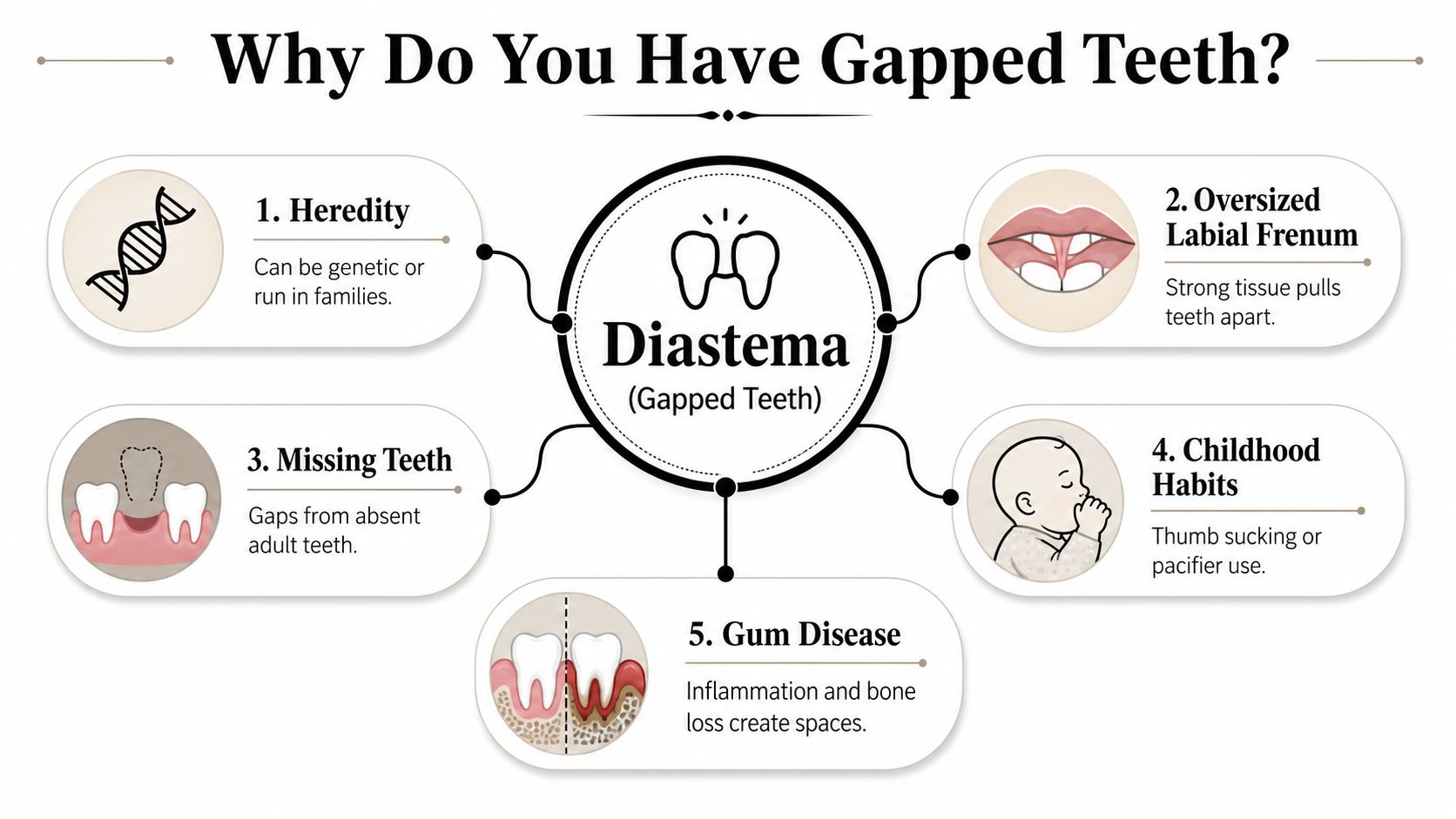 An infographic showing the five common causes of diastema, or gapped teeth, in the human mouth.